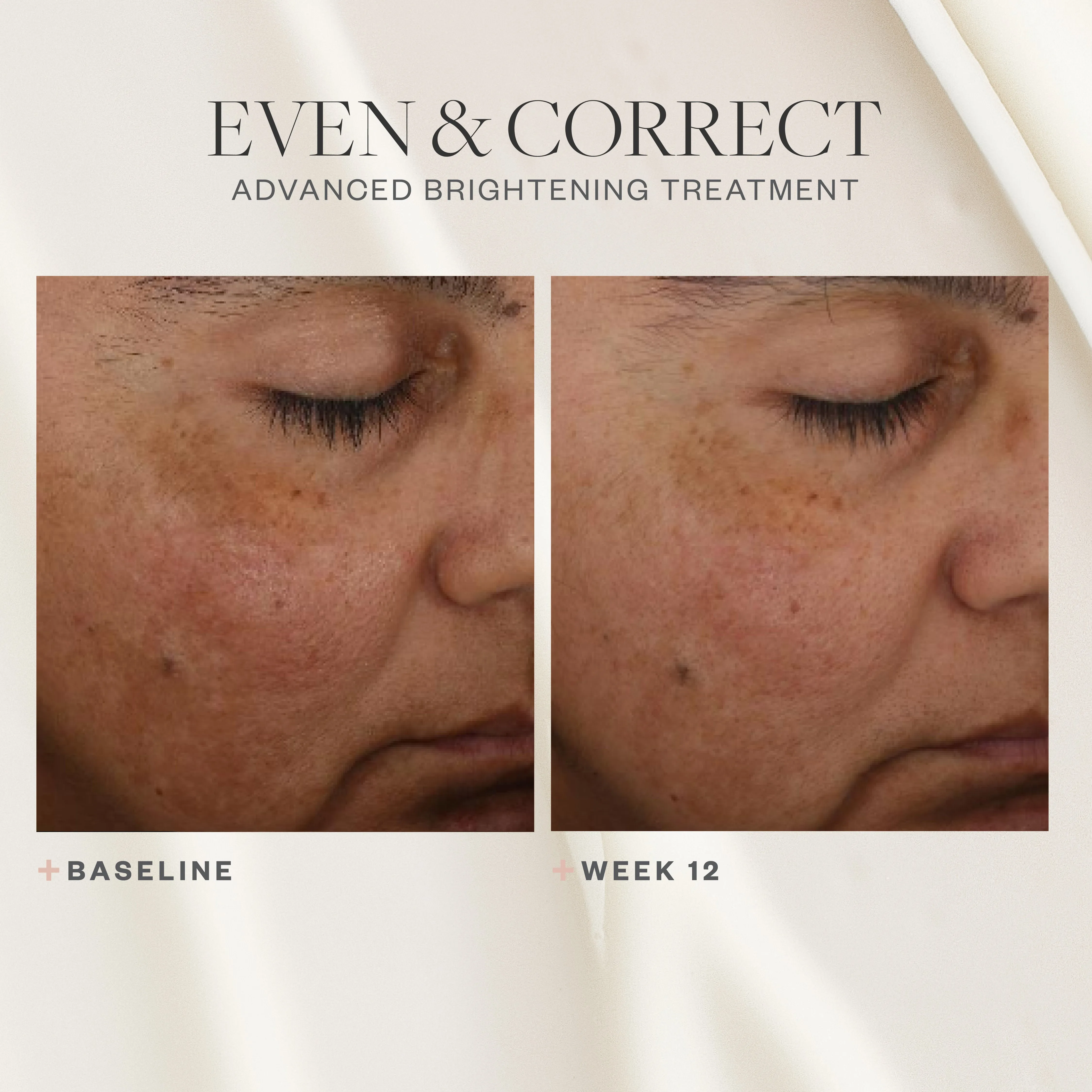 Even & Correct Advanced Brightening Treatment