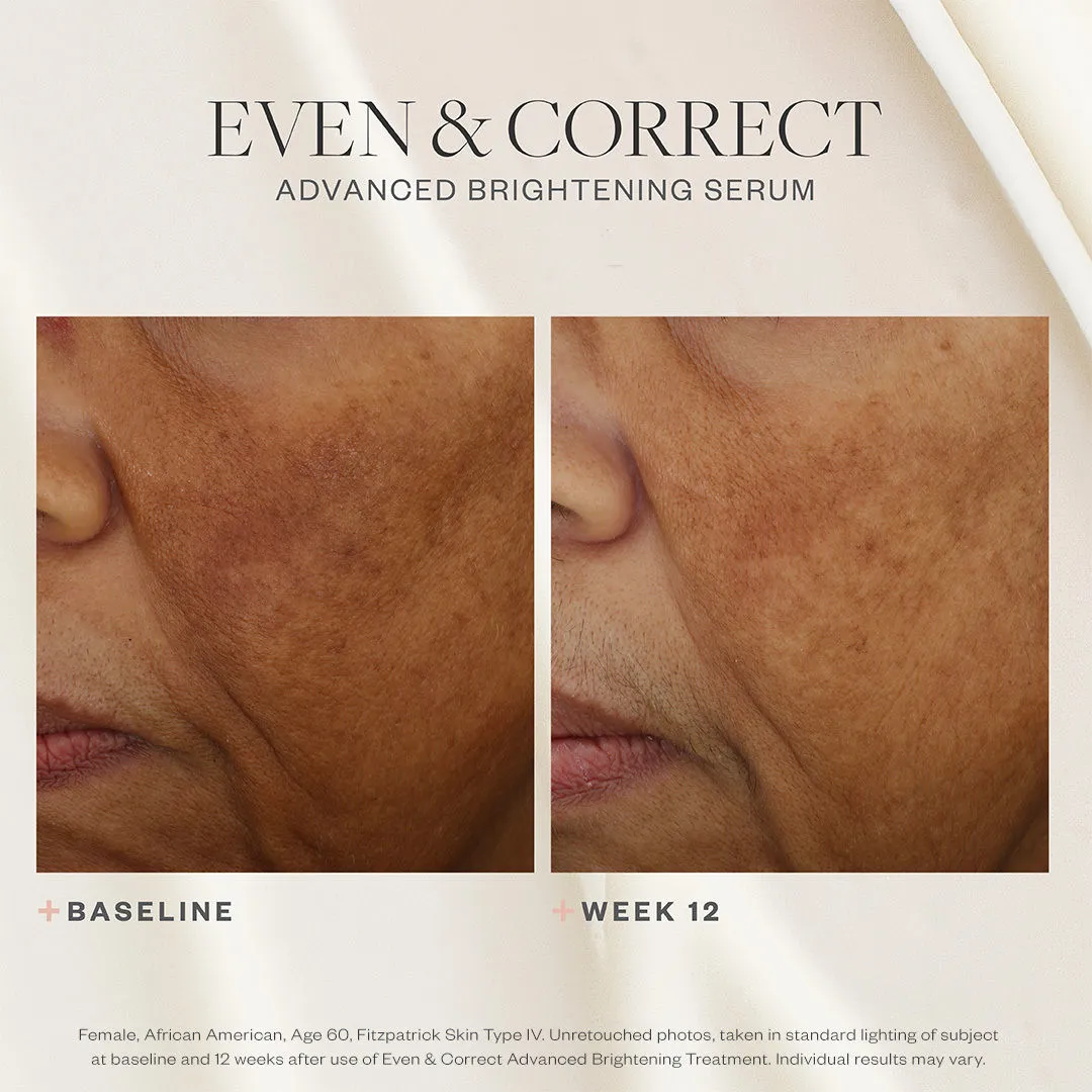 Even & Correct Advanced Brightening Treatment