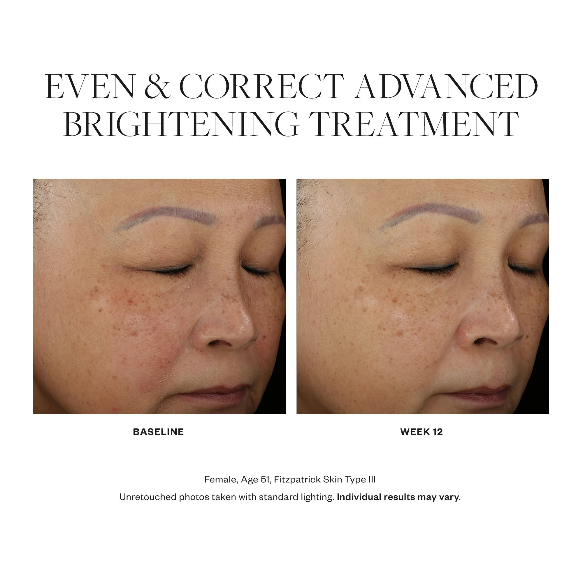 Even & Correct Advanced Brightening Treatment