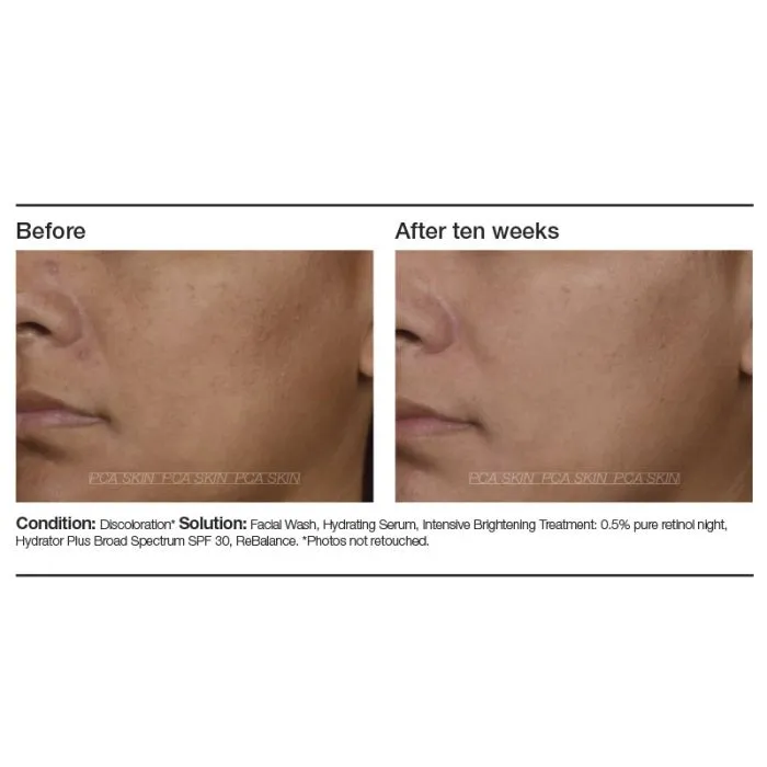 PCA Skin Intensive Brightening Treatment